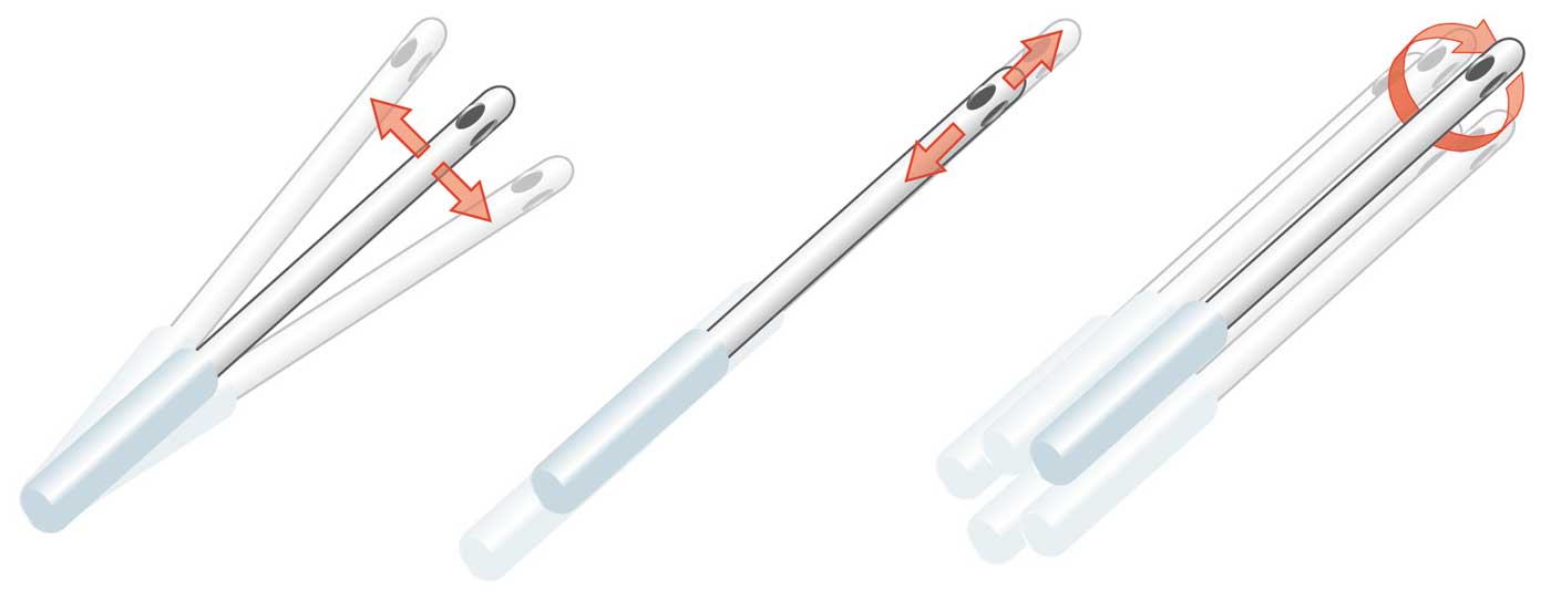 bewegungsschema-der-lipomatic-3diemnsional