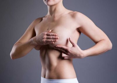 Vorher Nachher Bilder zu Mammatubuläre Deformität