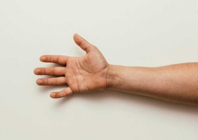 Nervenkompresionssyndrome