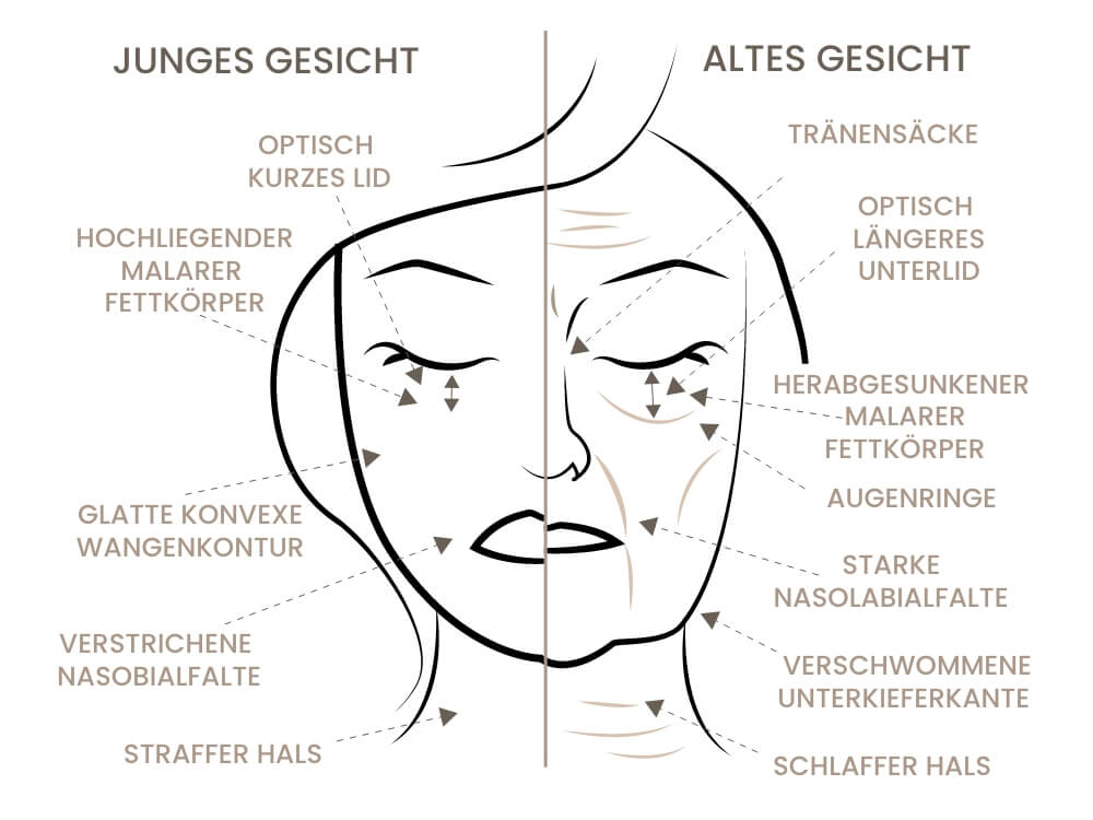facelift-schema-1