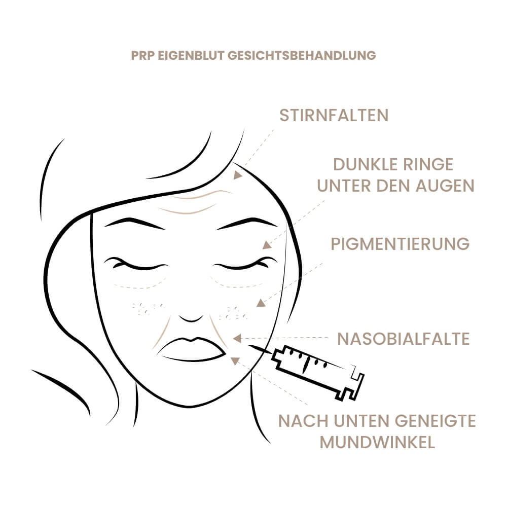 prp-gesichtsbehandlung