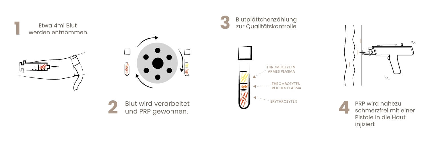 vampirelift-methode-turkof-3